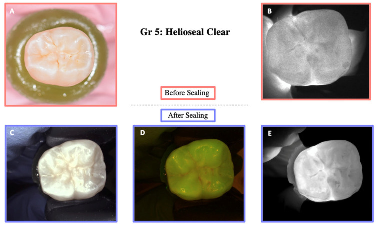 Figure 10