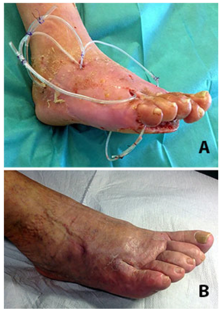 Figure 14