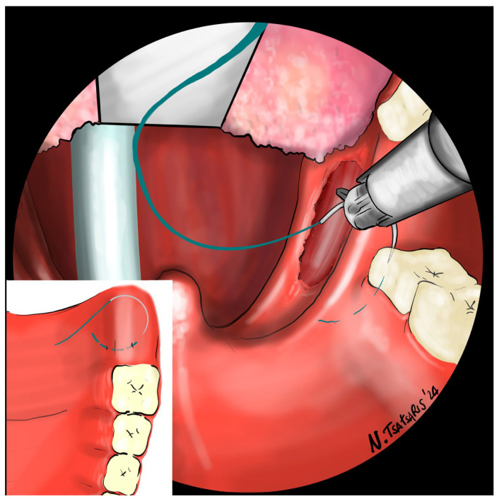 Figure 6