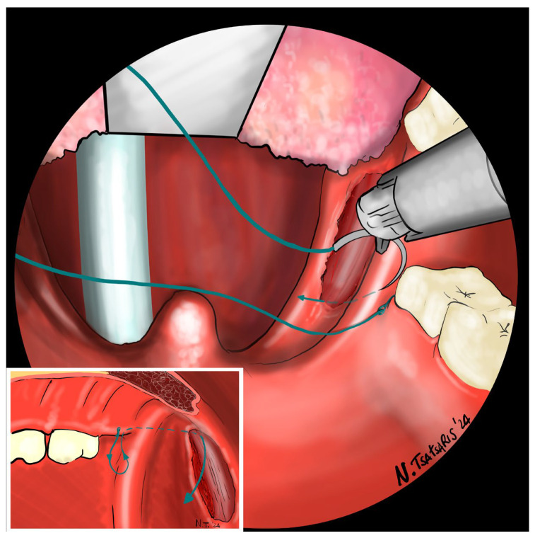 Figure 7