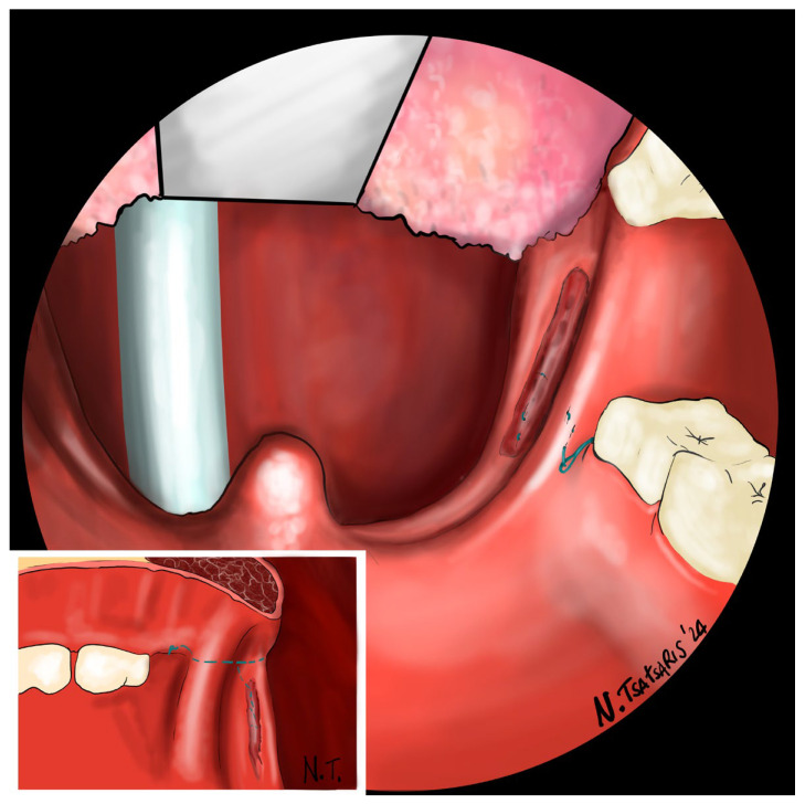 Figure 11