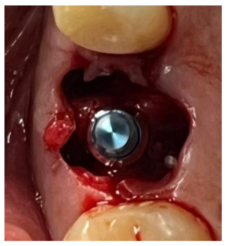 Figure 12