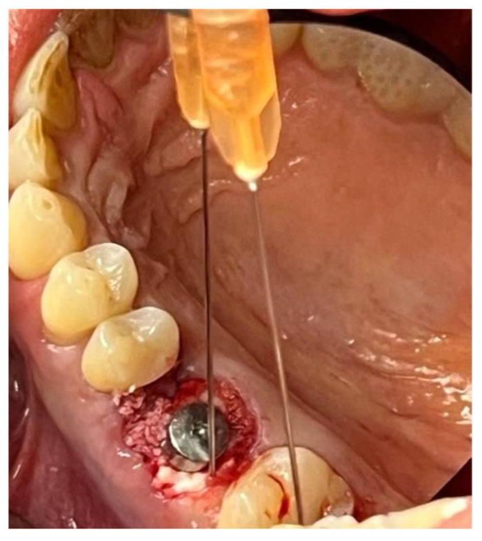 Figure 13