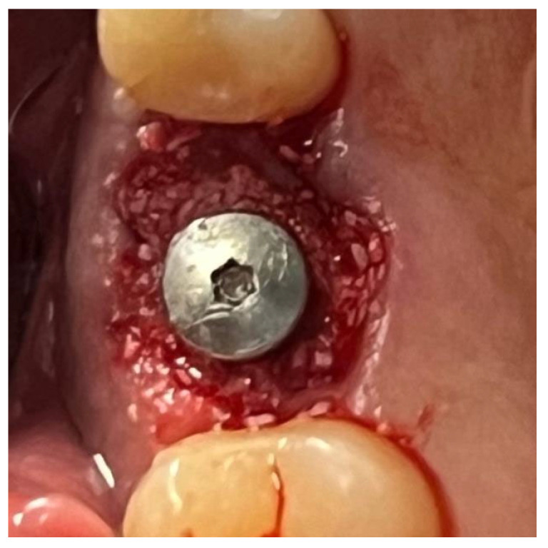 Figure 14