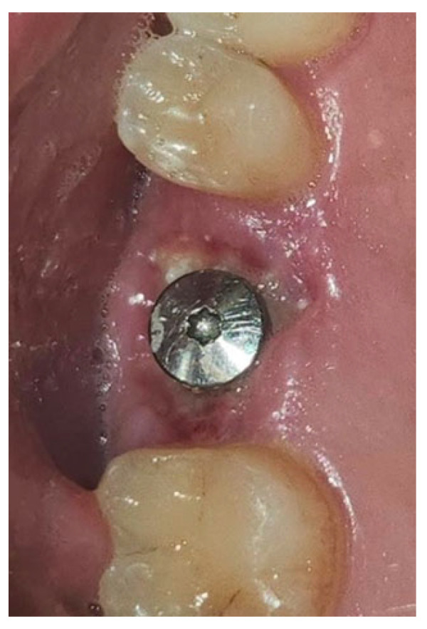 Figure 15
