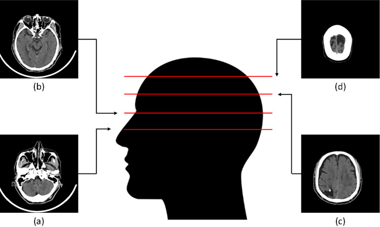 Fig 2