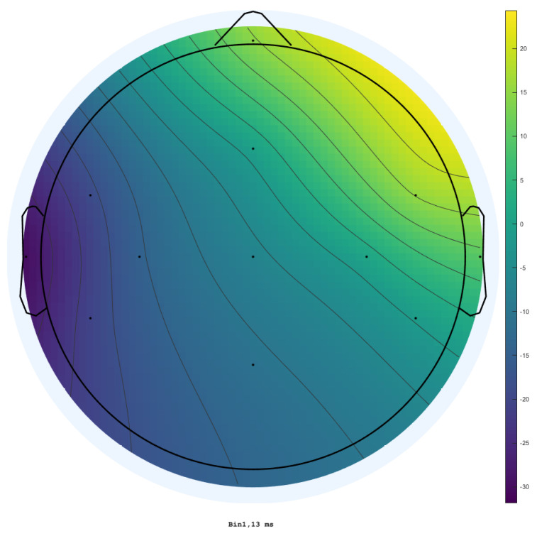 Figure 11