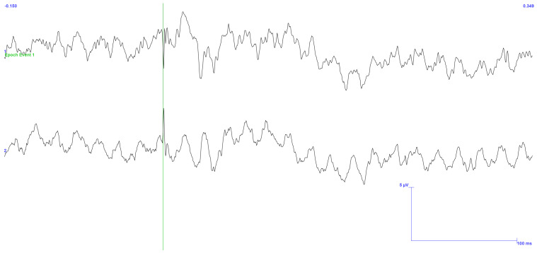 Figure 12