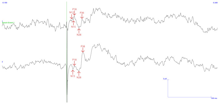 Figure 14