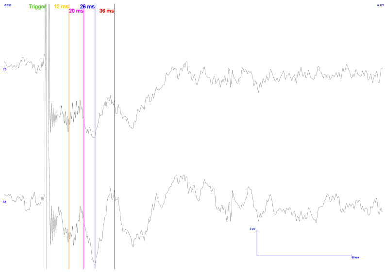 Figure 15