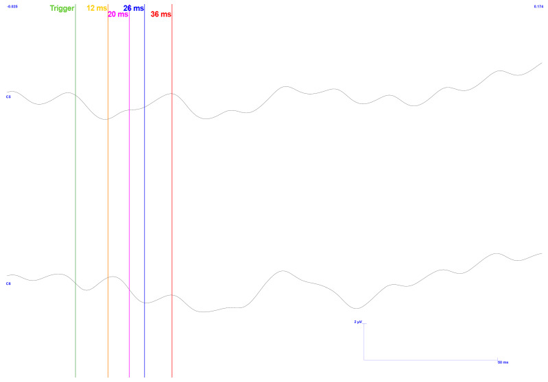 Figure 16