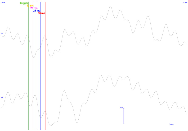 Figure 17
