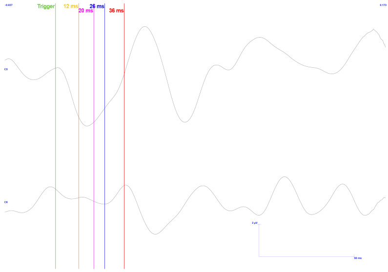 Figure 18