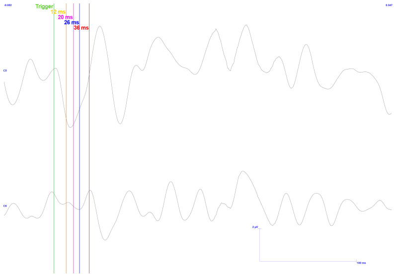 Figure 19