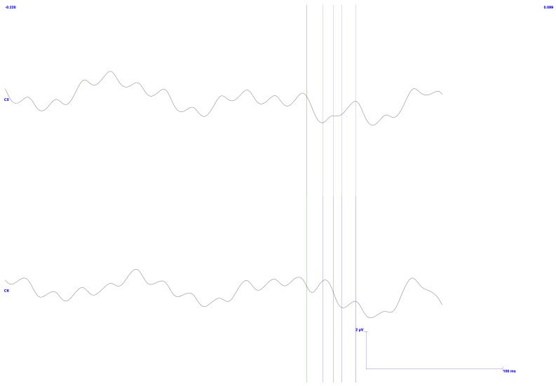 Figure 20