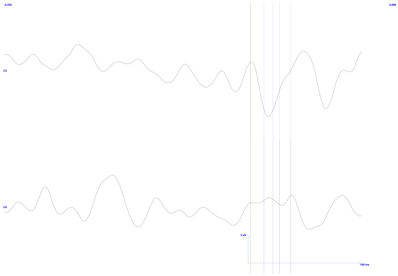 Figure 21