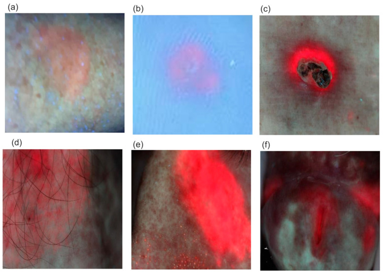 Figure 14
