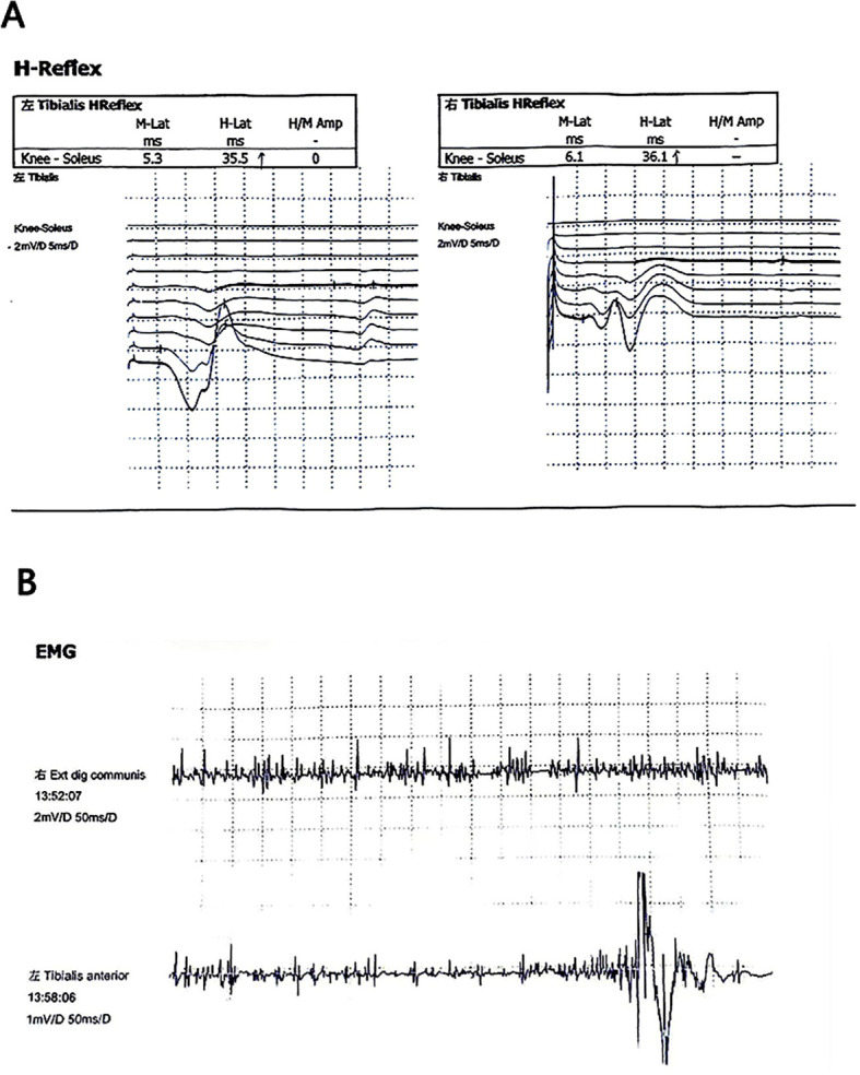 Figure 2