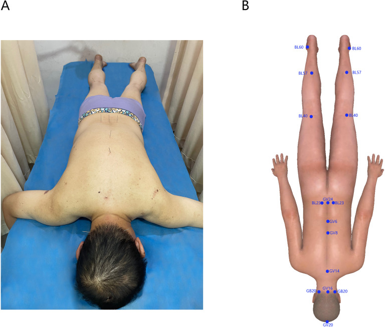 Figure 3
