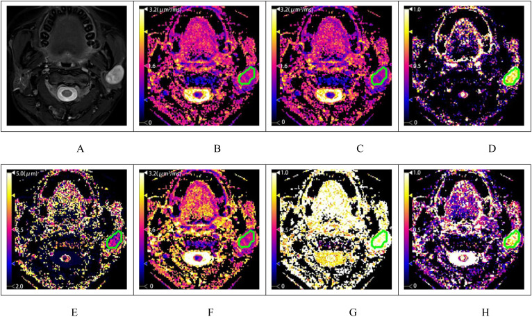 Figure 2