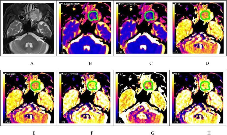 Figure 3