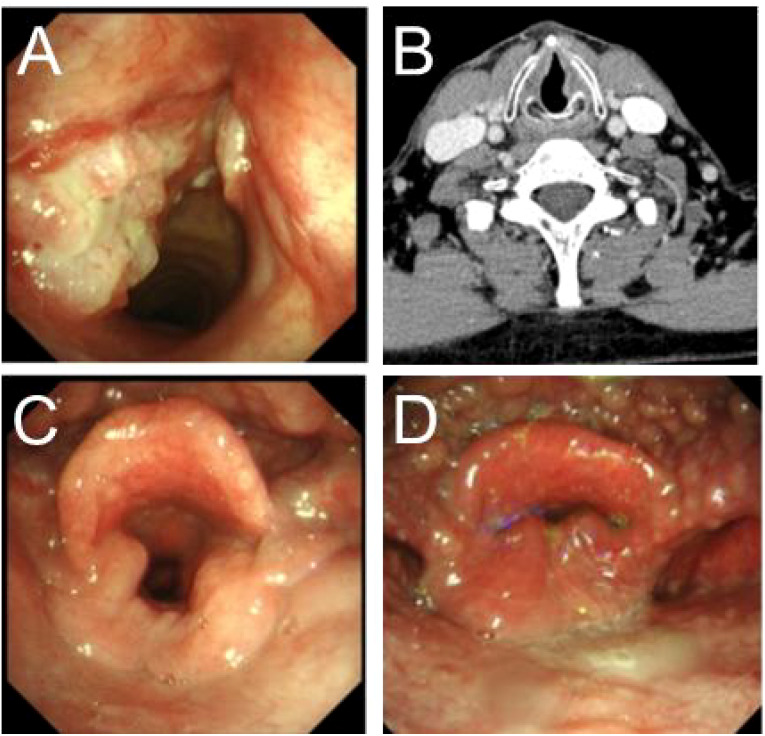 Figure 1