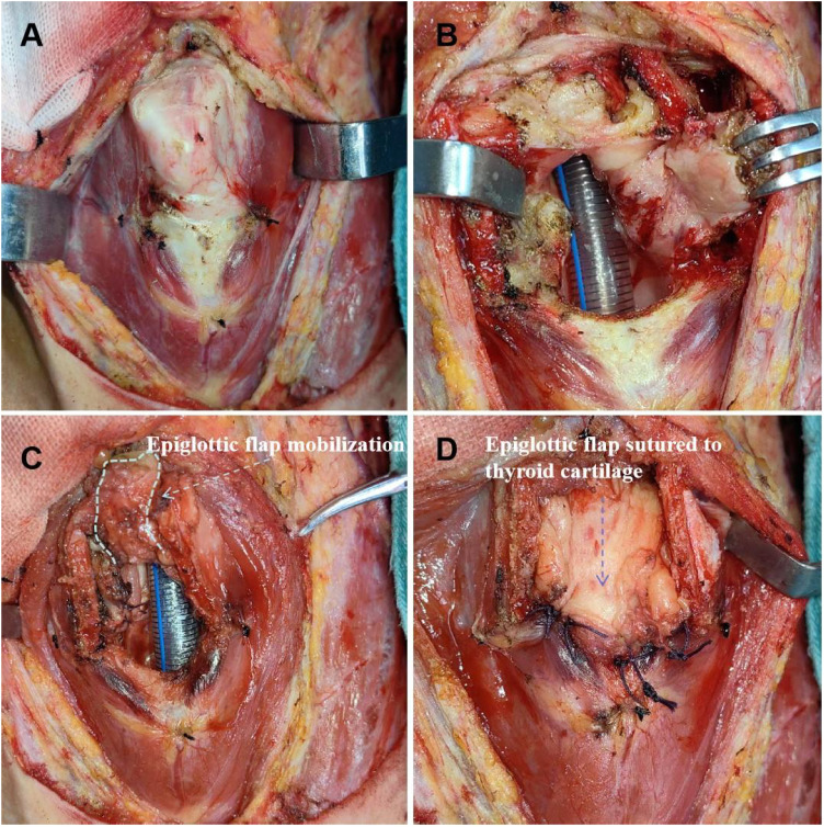Figure 3