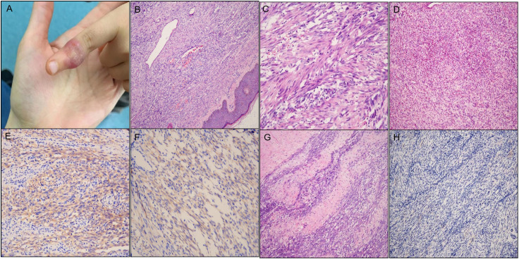 Figure 2