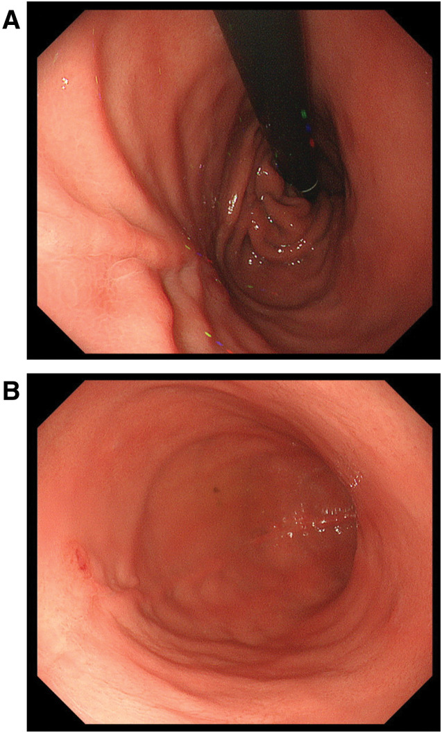 Fig. 5