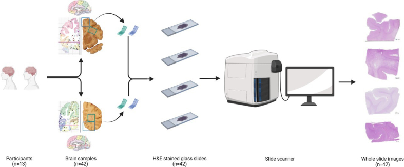 Figure 1: Overview of the process for sampling and digitization of
slides