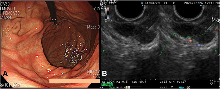 Fig. 1