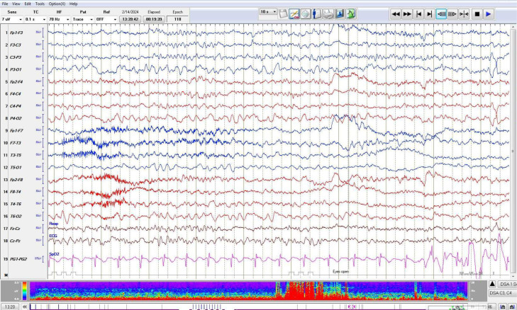 Figure 5