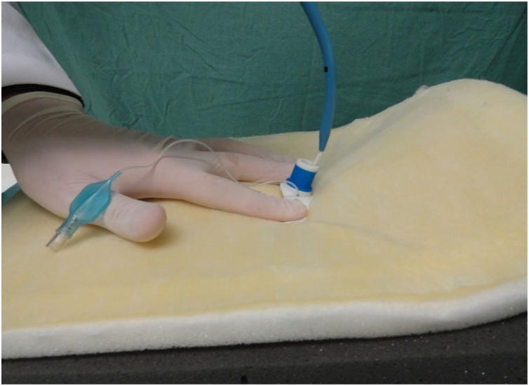 Figure 11