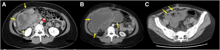 Fig. 1