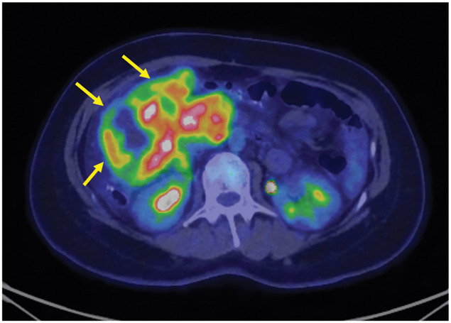 Fig. 3
