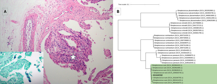 Fig 1