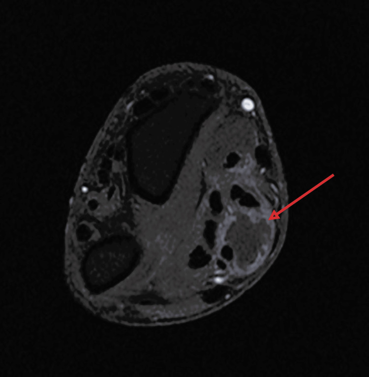 Figure 7