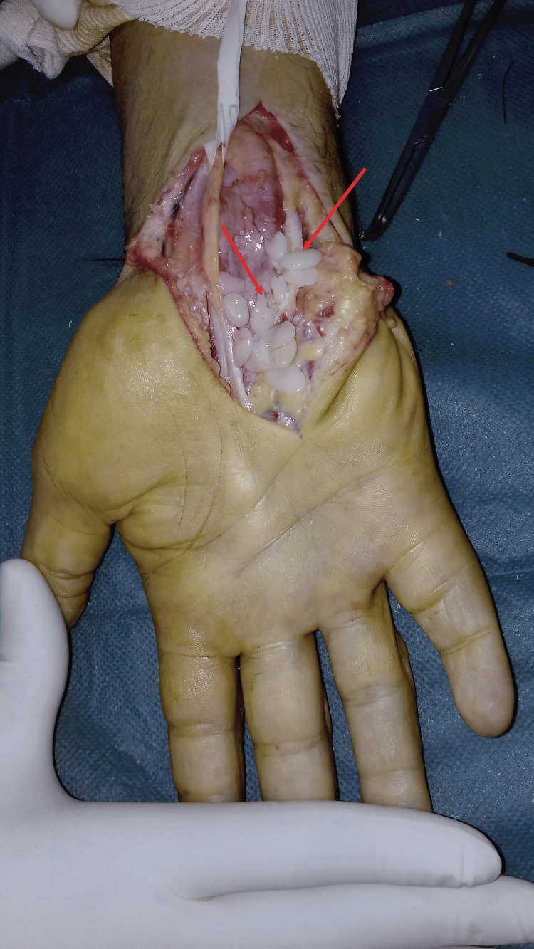 Figure 9