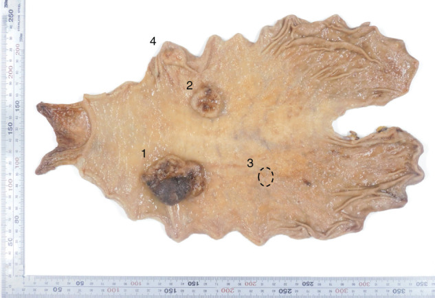 Fig. 3