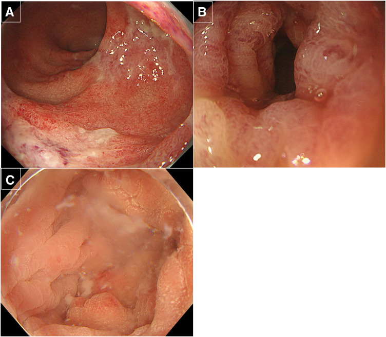 Fig. 2