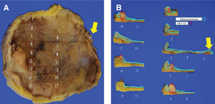 Fig. 3