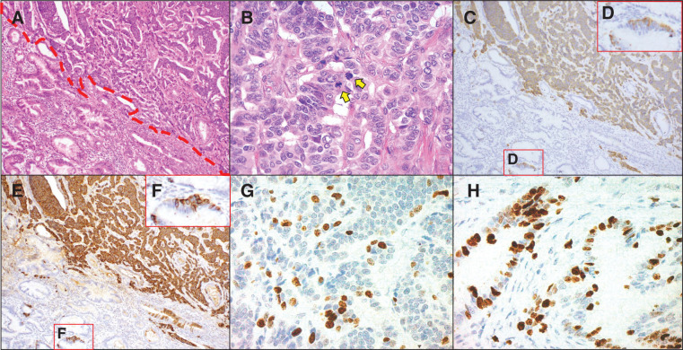 Fig. 4