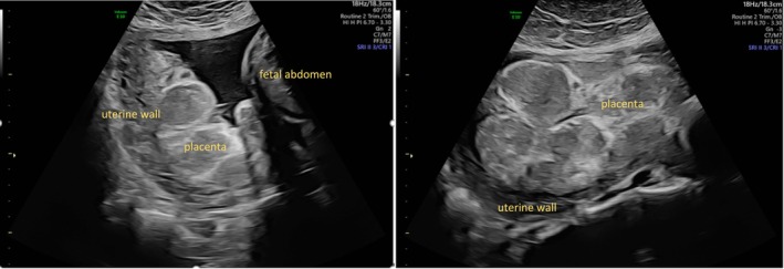 FIGURE 3