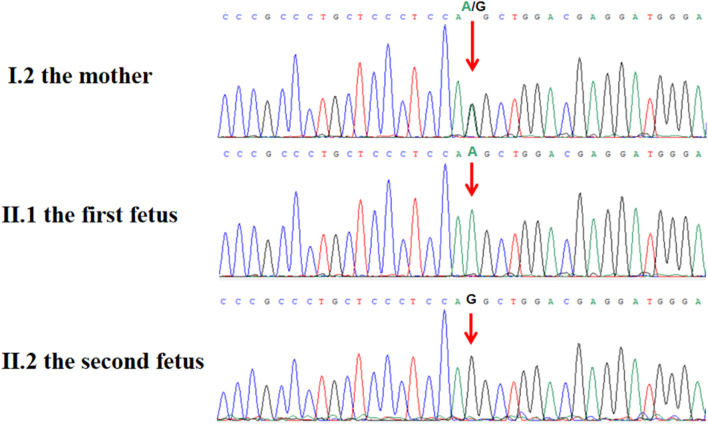 FIGURE 3