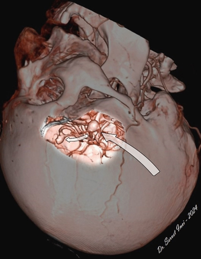 Figure 10