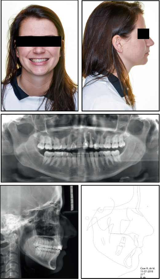 Figure 12