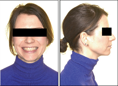 Figure 14