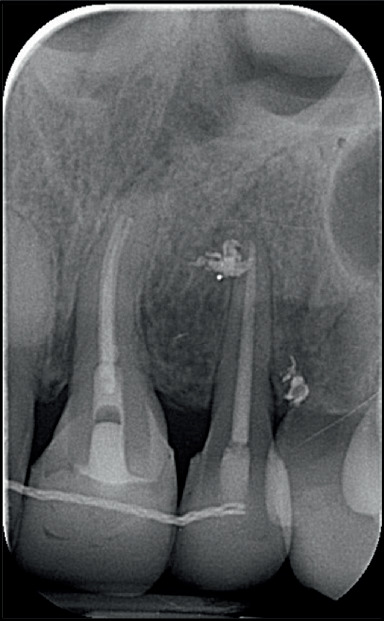 Figure 15
