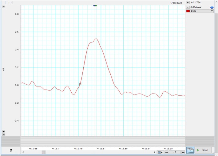 FIGURE 2