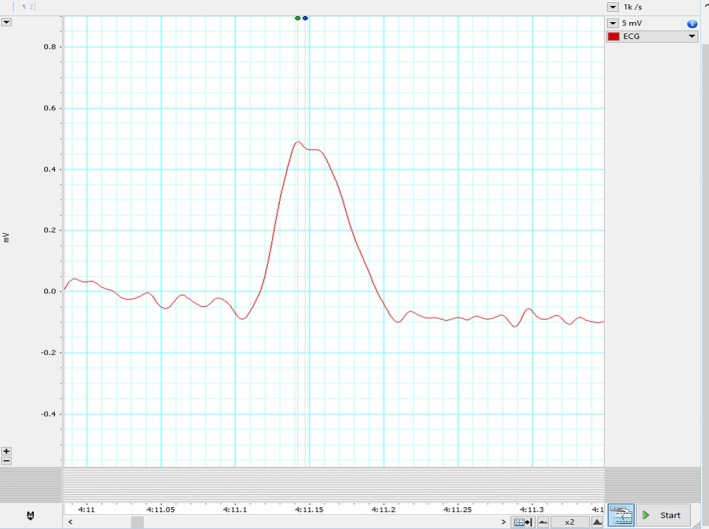FIGURE 3